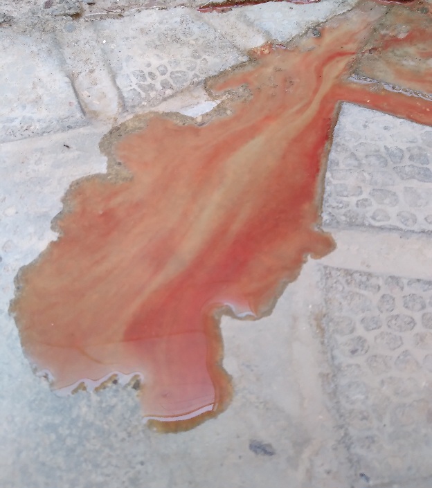 ادرار خونی